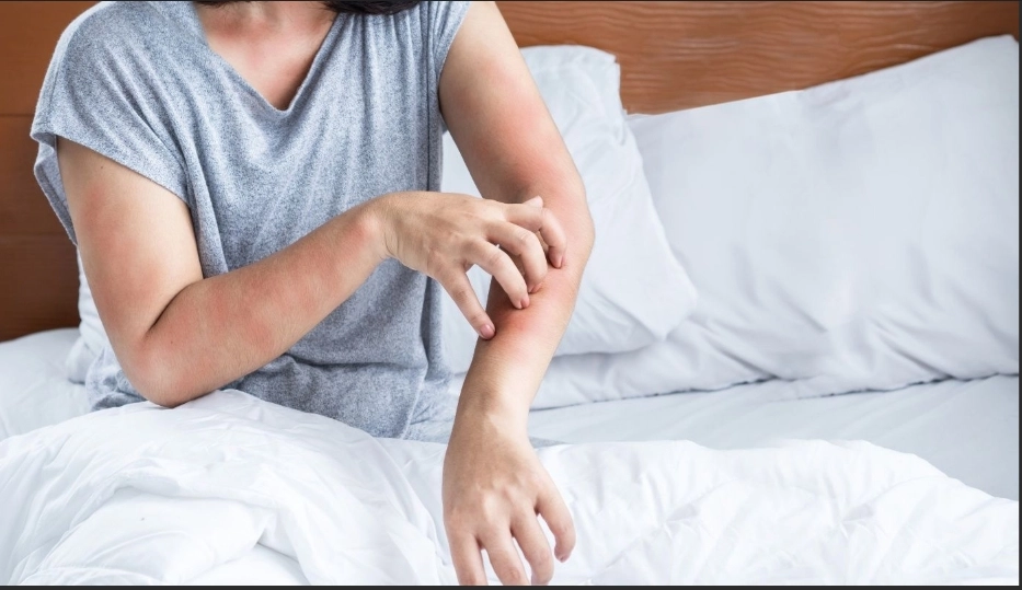 Do Skin Problems Increase During Menopause? Symptoms & Prevention