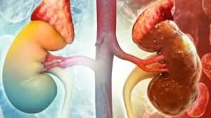 2 Magical Ways to Protect Your Kidney Health