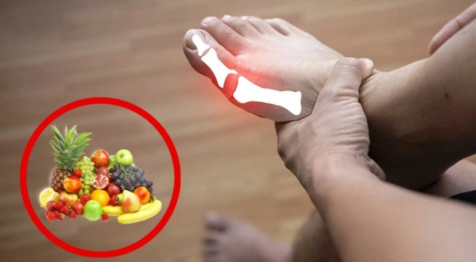 4 Vitamin C Fruits to Lower High Uric Acid and Purines