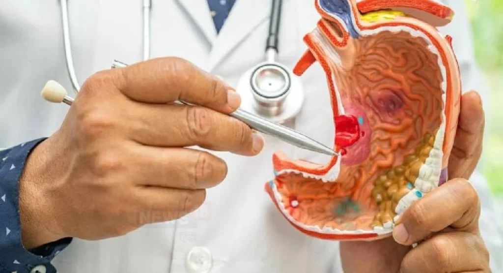 AI MRI Machine Reveals Hidden Stomach Cancer Secrets in 30 Minutes