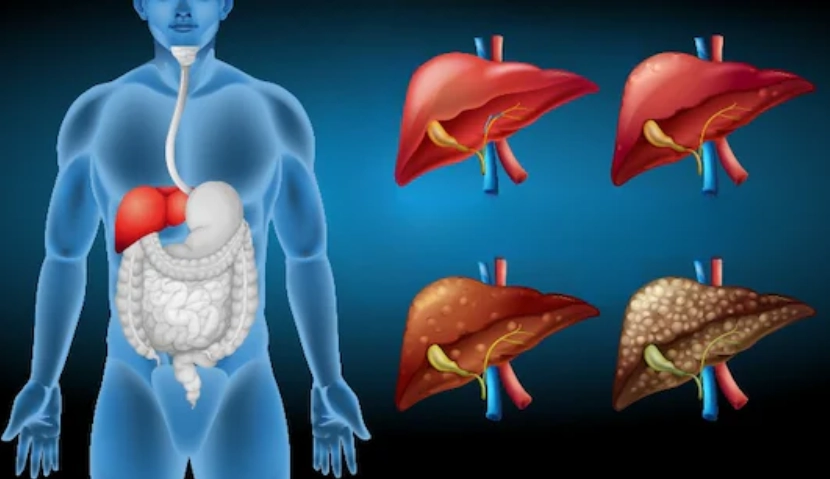5 Liver Trouble Symptoms You Should Never Ignore
