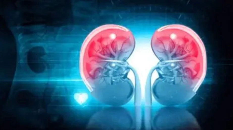 Stone Patients Should Avoid These to Prevent Complications