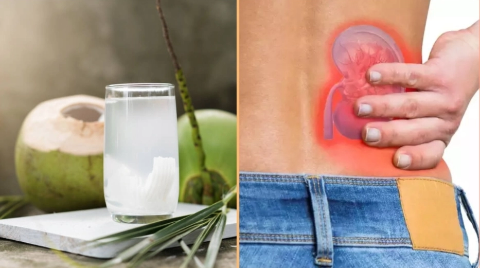 Banana and Coconut Water: Your Healthy Weapons Against Stones