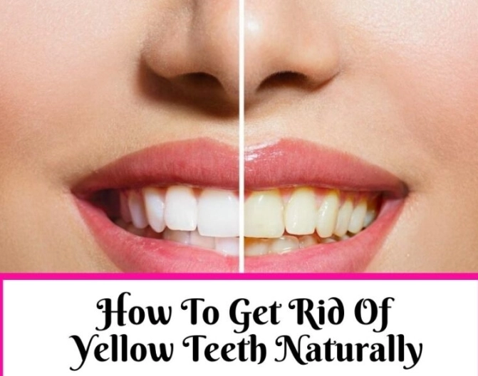 Natural Remedies to Eliminate Yellow Teeth and Bad Breath