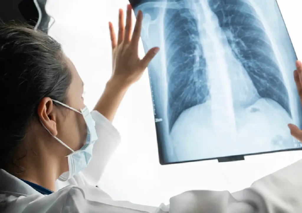 Hidden Habits That Increase Lung Cancer Risk