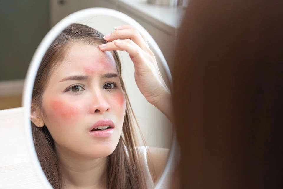Protect Your Skin from Sunburn: Easy Tips for Hot Weather