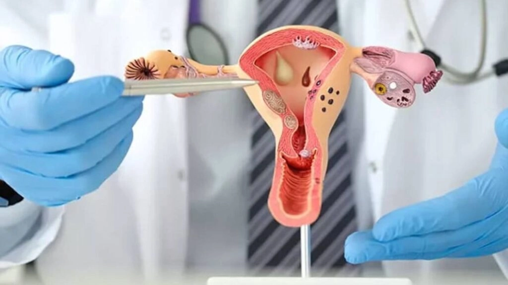 Rising PCOS in Young Women: 3 Everyday Habits to Avoid