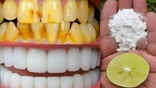 5 Home Remedies for Pearly White Teeth