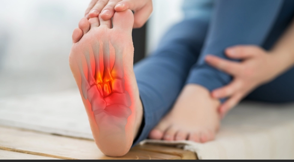 Pain Locations in Plantar Fasciitis: Causes and Solutions