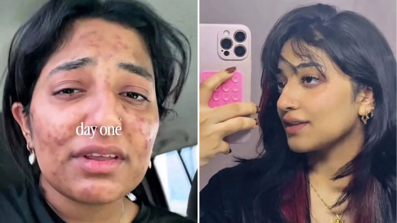 Dubai Girl's Video: Two Simple Changes Transformed Her Skin