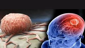 5 Habits That May Shrink Your Brain: Doctor's Tips to Avoid