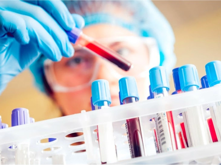 5 Essential Tests for Women at Age 30: Know the Details!