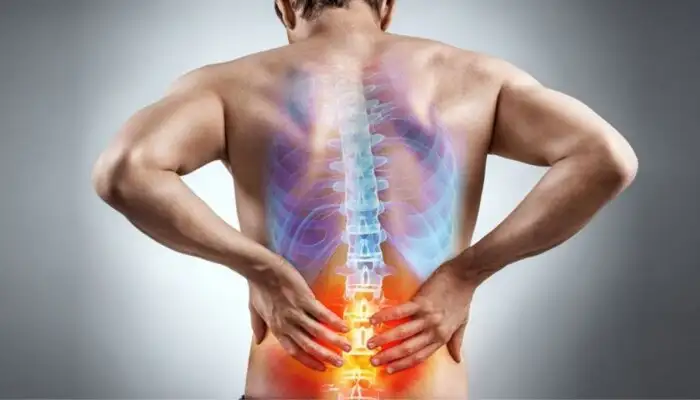 Home Remedies for Back Pain Relief