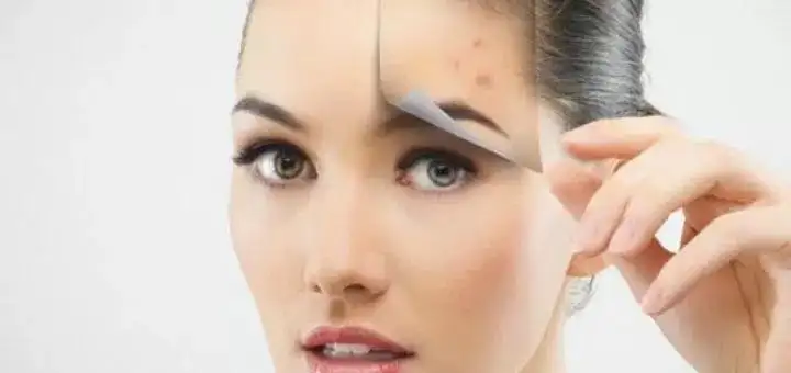 Home Remedies for Blemish Removal on the Face