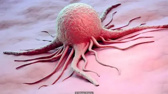 Affordable Cancer and Respiratory Disease Diagnosis at Hospital