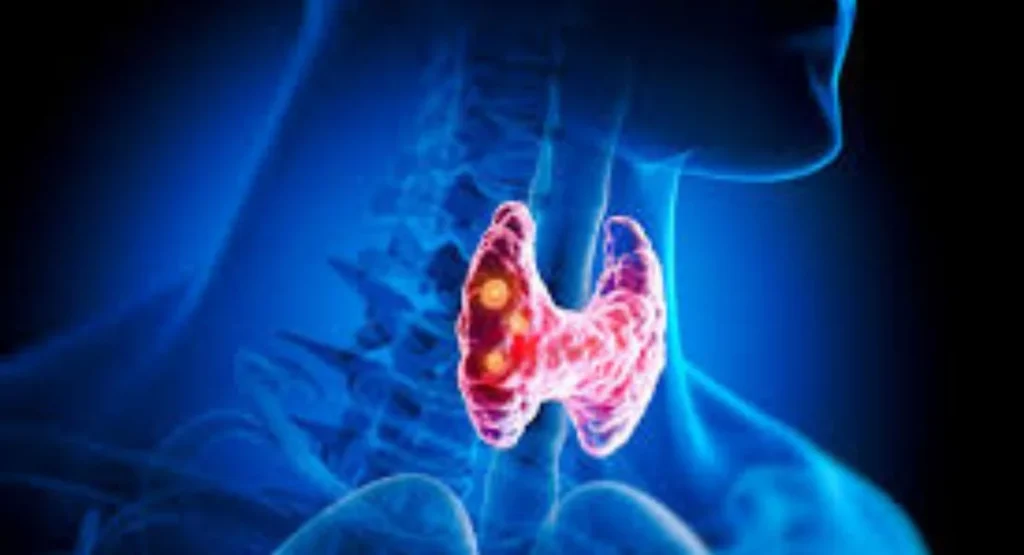 Quick Home Remedy for Thyroid Issues: Results in 15 Days