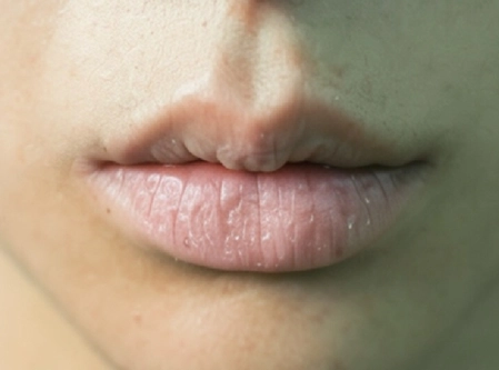 Relief from Chapped Lips to Wrinkles with Vaseline