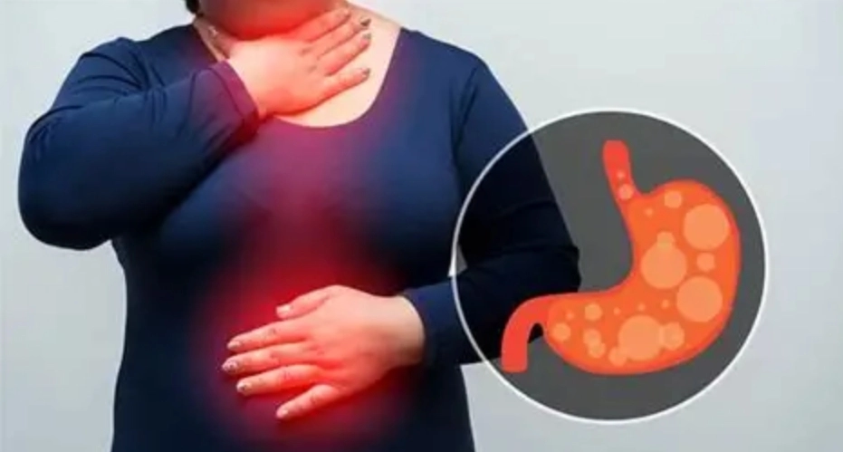 Easy Tips for Relief from Constipation, Gas, and Acidity