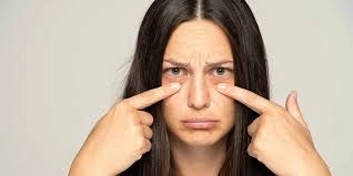 Persistent Under-Eye Puffiness: Signs of Potential Kidney Disease