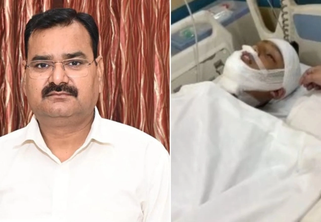 UP Minister's Nephew Injured by Chinese Manja